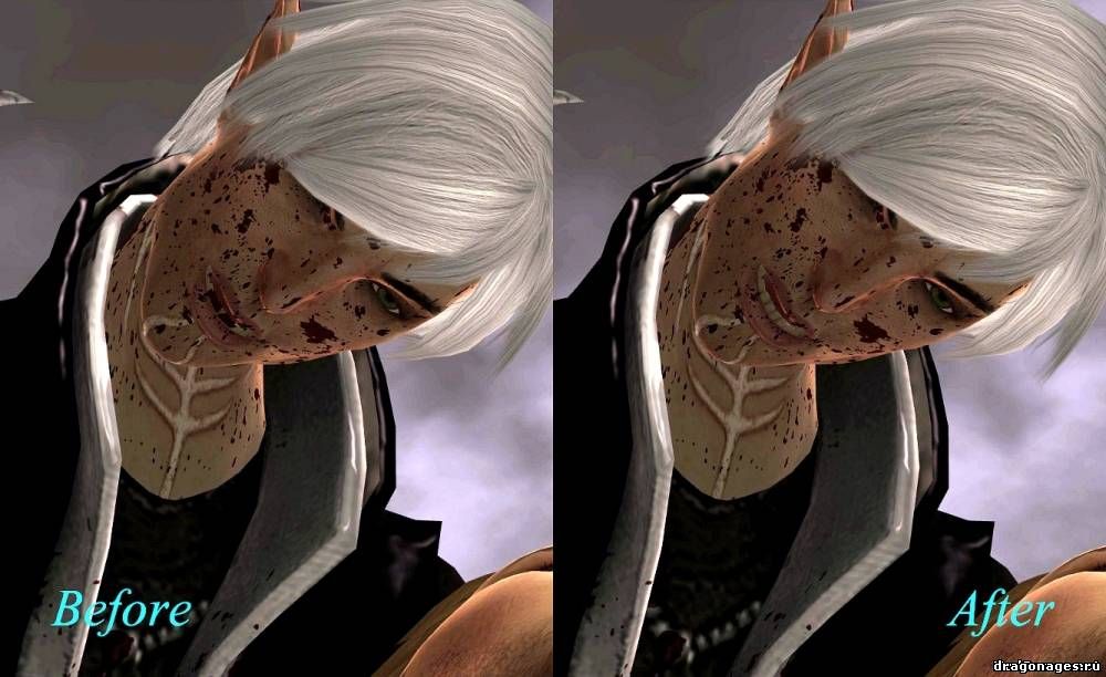 No More Bloody Teeth/Нет крови на зубах